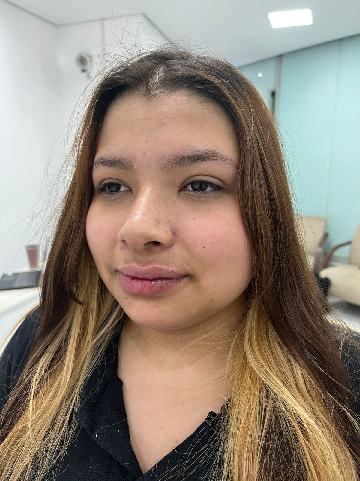 Resultado de procedimento 2